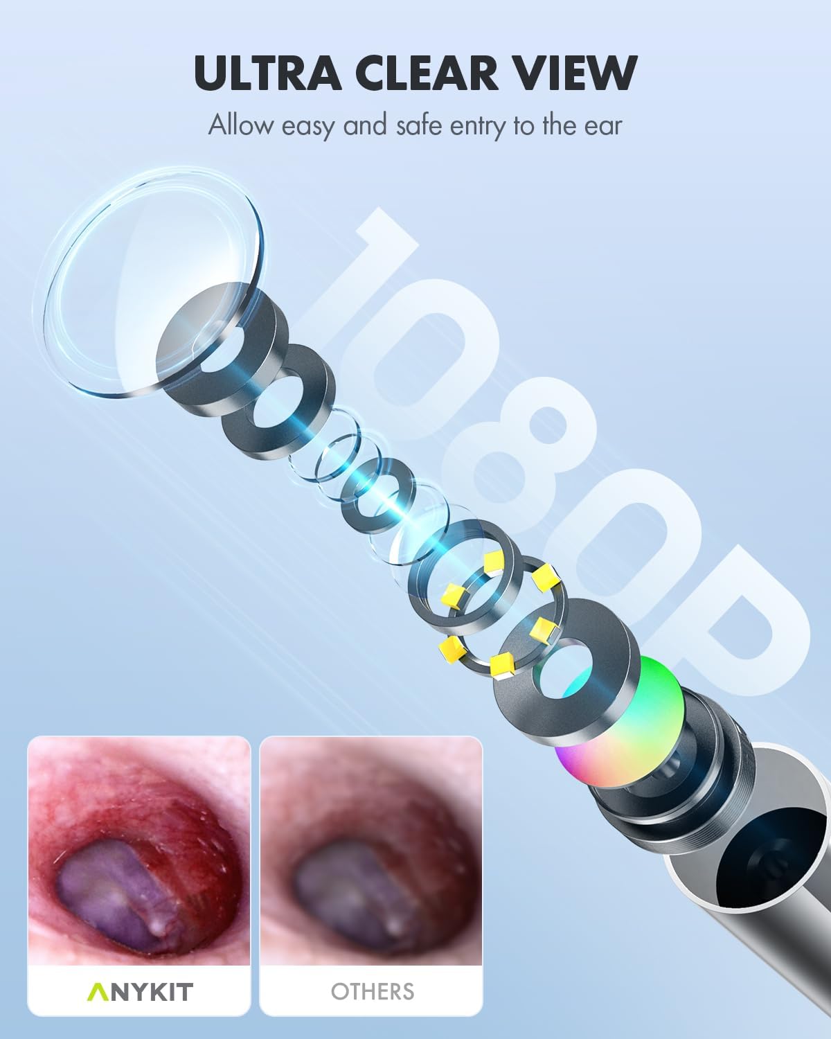 Ear Wax Removal Tool with LED Lights Otoscope O205